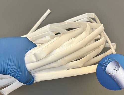 Vascular Conduits: The Role of ePTFE-Covered Stents in Cardiac Interventions