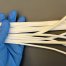 eptfe tube